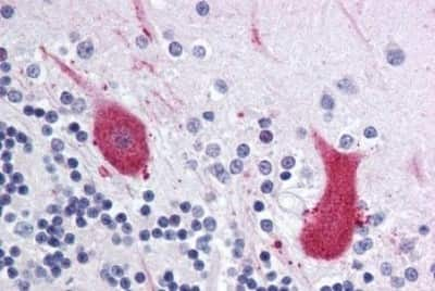 Immunohistochemistry-Paraffin: MARK1 Antibody [NBP3-14396]